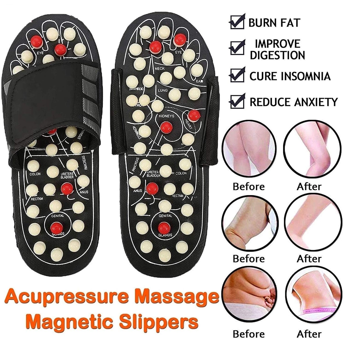 Acupressure and Magnetic Therapy Slippers |ðŸ”¥FLAT 50% OFF SALEðŸ”¥